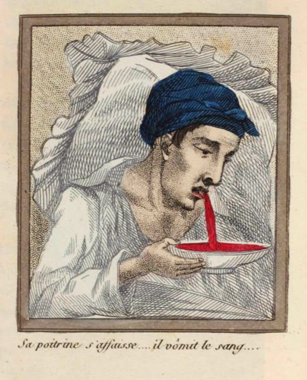 efectos del FAP ilustrados en un libro de 1830 (9)