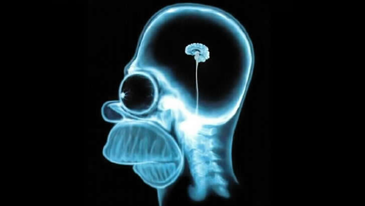 homero-cerebro-radiografia.jpg