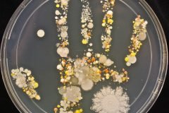 El maravilloso resultado de la bióloga que cultivó microbios de la mano de su hi...