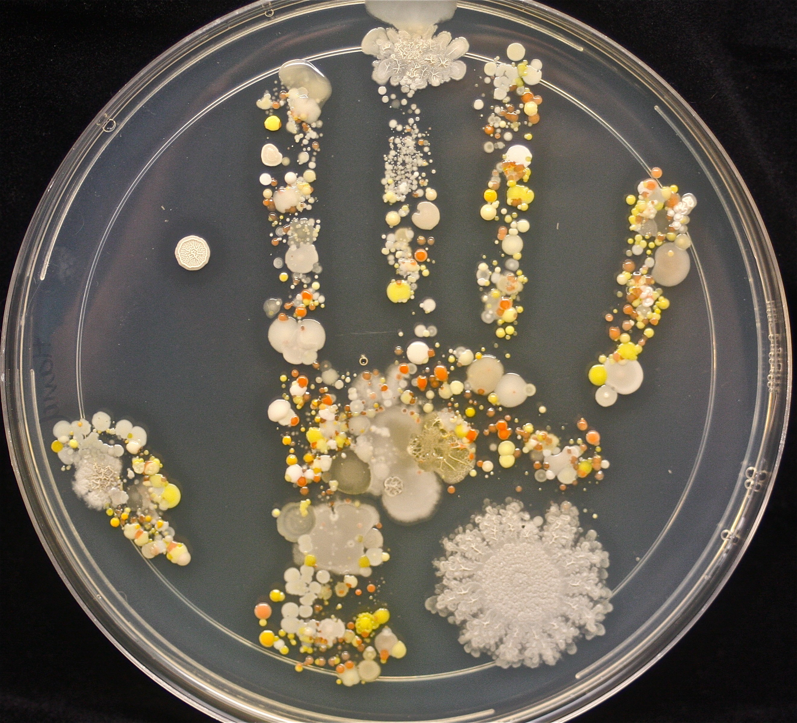 Estos son los microbios que estaban en la mano del pequeño después de jugar en el jardín. 