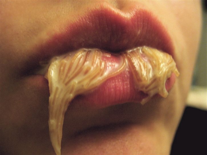 asqueroso gusanos boca