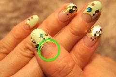 ¿Tienes manchas blancas semicirculares en las uñas?