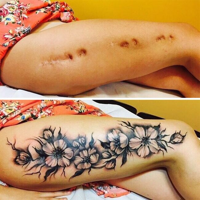 cicatrices convertidas en tatuajes (5)