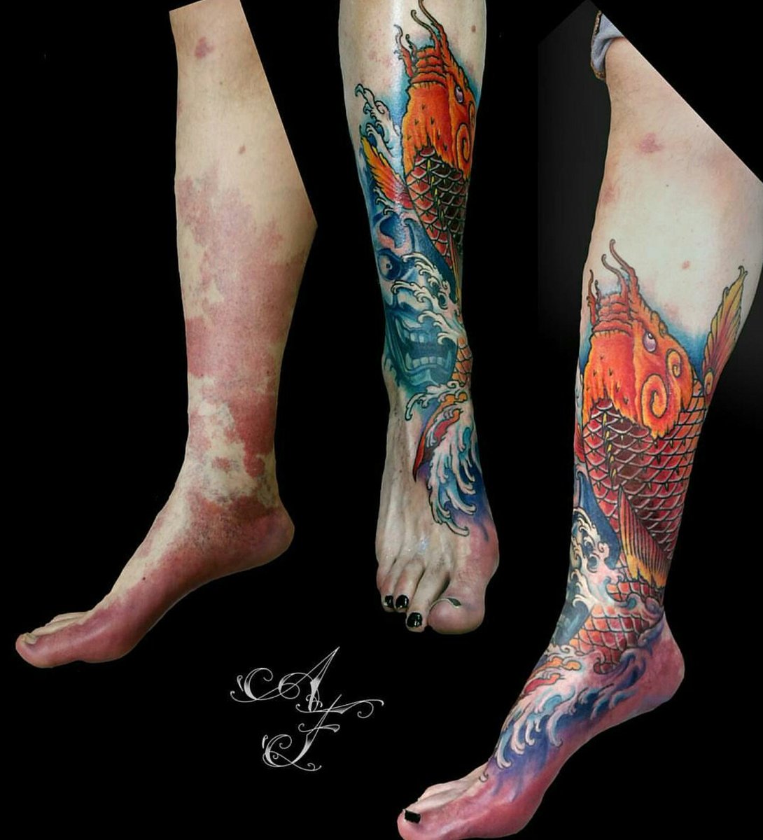 marcas de nacimiento tatuajes (2)