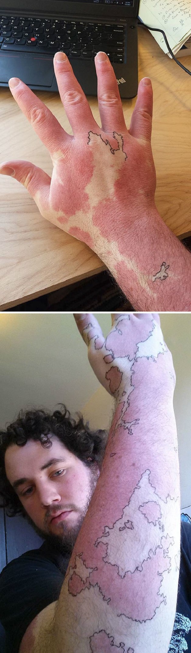marcas de nacimiento tatuajes (9)
